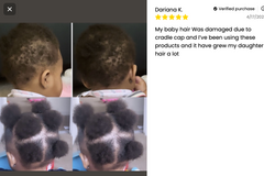 J Organic solutions Kid's Scalp Stimulator