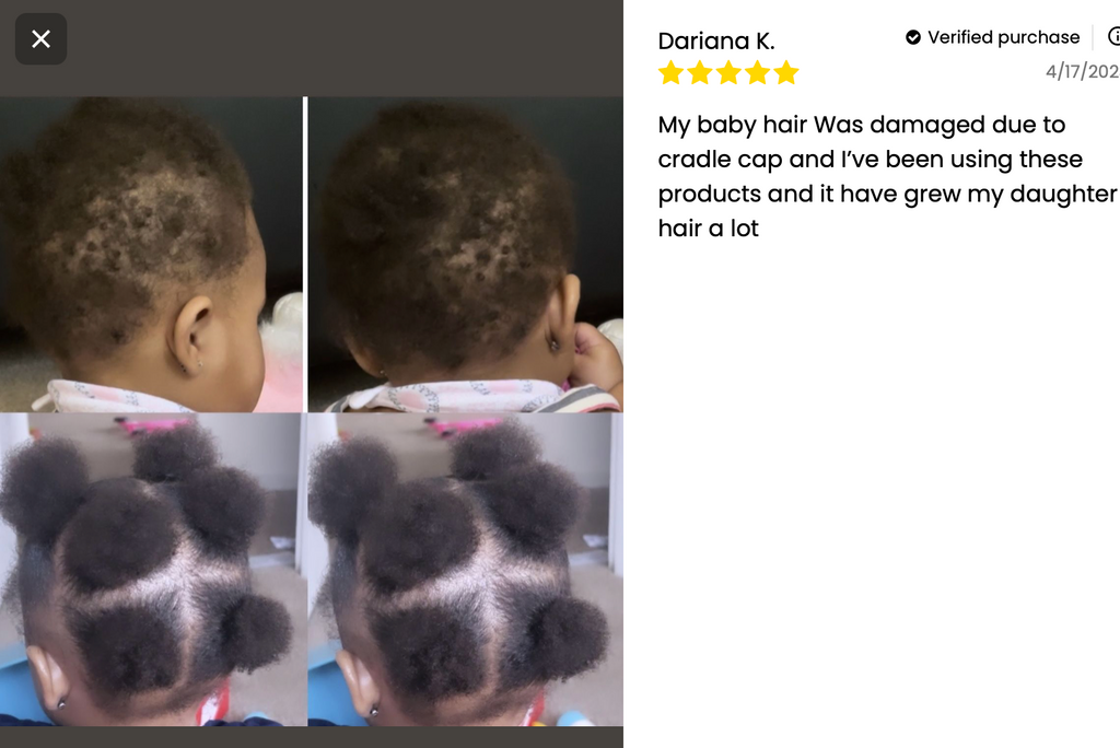J.O.S Kid's Super healthy Hair kit