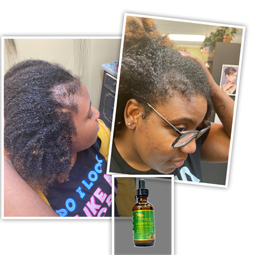 J Organic solutions Healthy Hair Growth Set (Complete 5 product bundle)