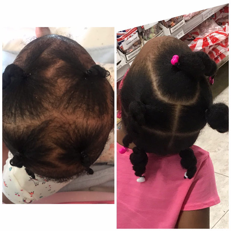 J Organic solutions Kid's healthy Hair kit (4 products)