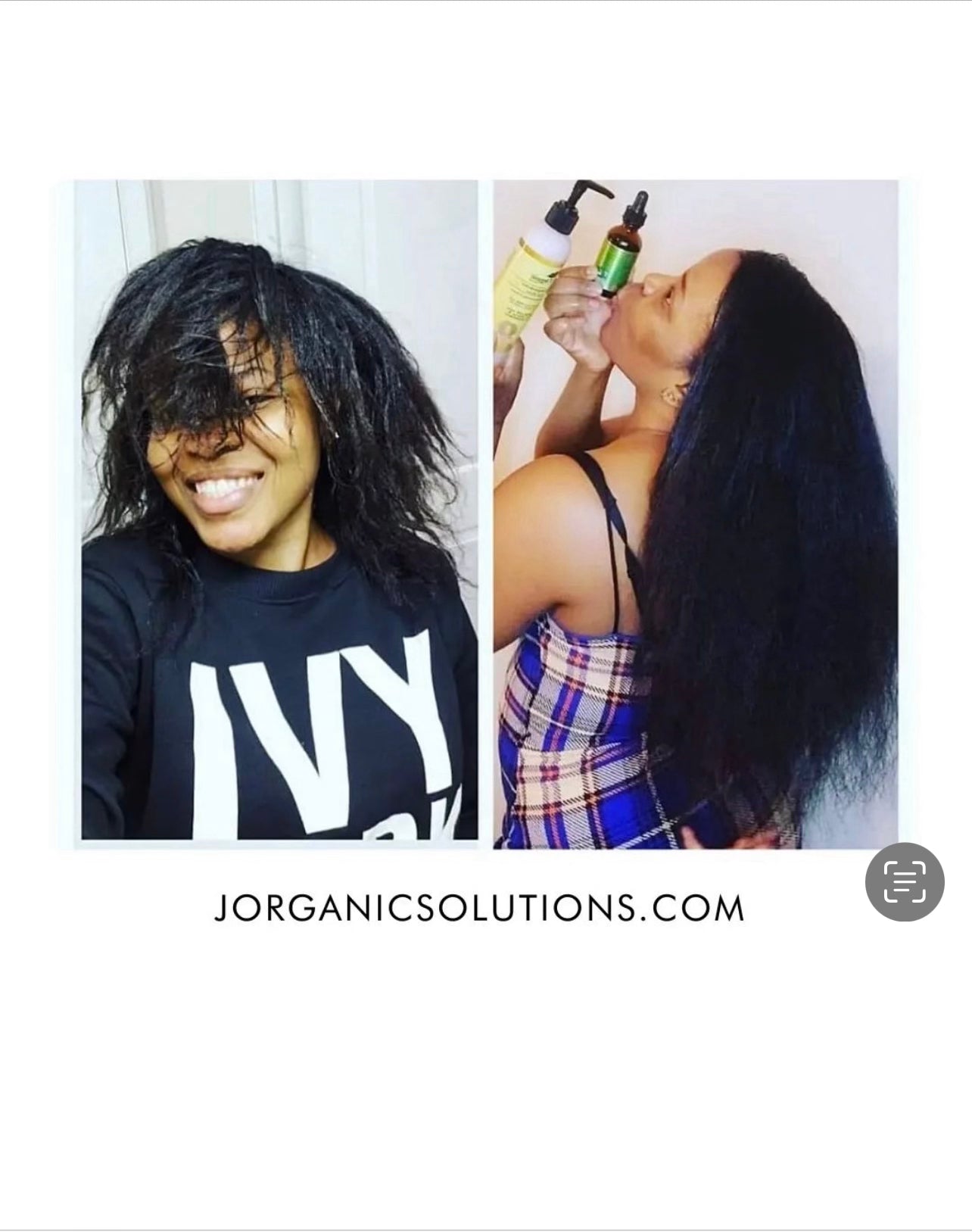 J Organic solutions Healthy Hair Growth Set (Complete 5 product bundle) Secondary image