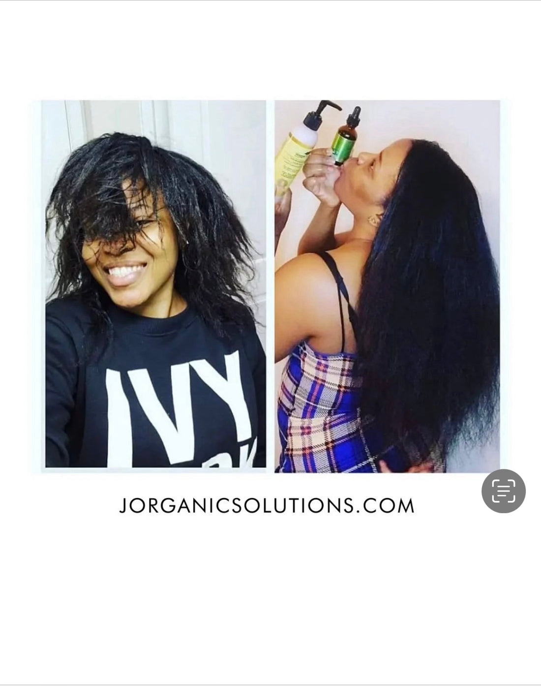 J Organic solutions Healthy Hair Growth Set (Complete 5 product bundle)